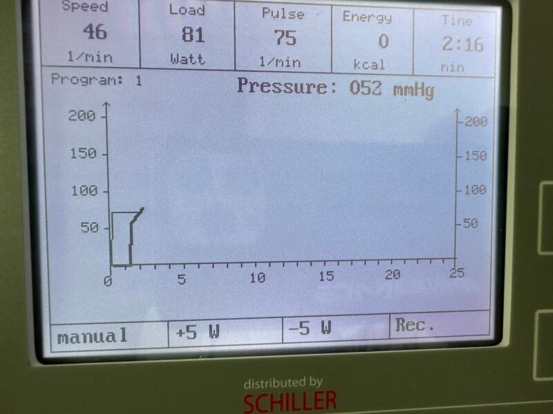 Schiller Ergosana ERG 911 BP/LS Liegeergometer mit Blutdruckmessung