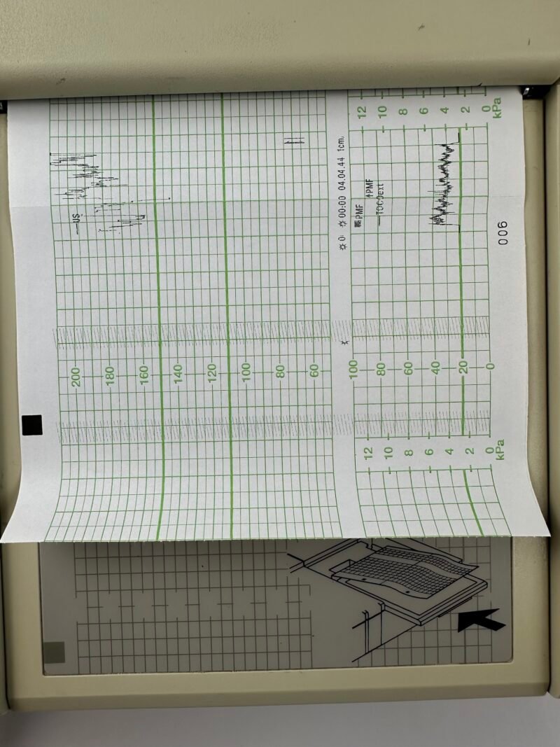 Hewlett-Packard Series 50 IP M1353A Fetalmonitor mit US- und TOCO-Sensor